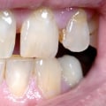 Can a Dentist Tell if You Do Drugs?
